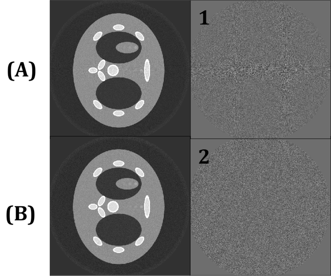 These images show the demonstrable effect of the DBA on CT image noise.  Both are scans of a phantom.  In image A, there is clearly higher noise in the areas of the phantom with higher Density.  In image B (with the use of DBA) the signal to noise is uniform. This results in a more clear final CT image.  In addition, scan B used 22% less dosage than image A.