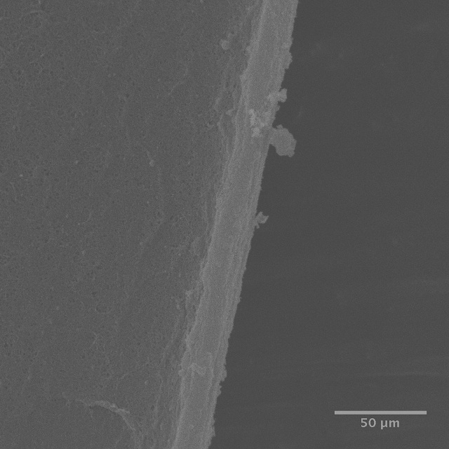A scanning electron microscope image of an edge cut using the commonly used continuous curvilinear capsularhexis (CCC) method.  The edge is fairly smooth with no visible microtears.