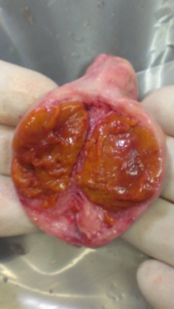 Fresh Ovary Dissected