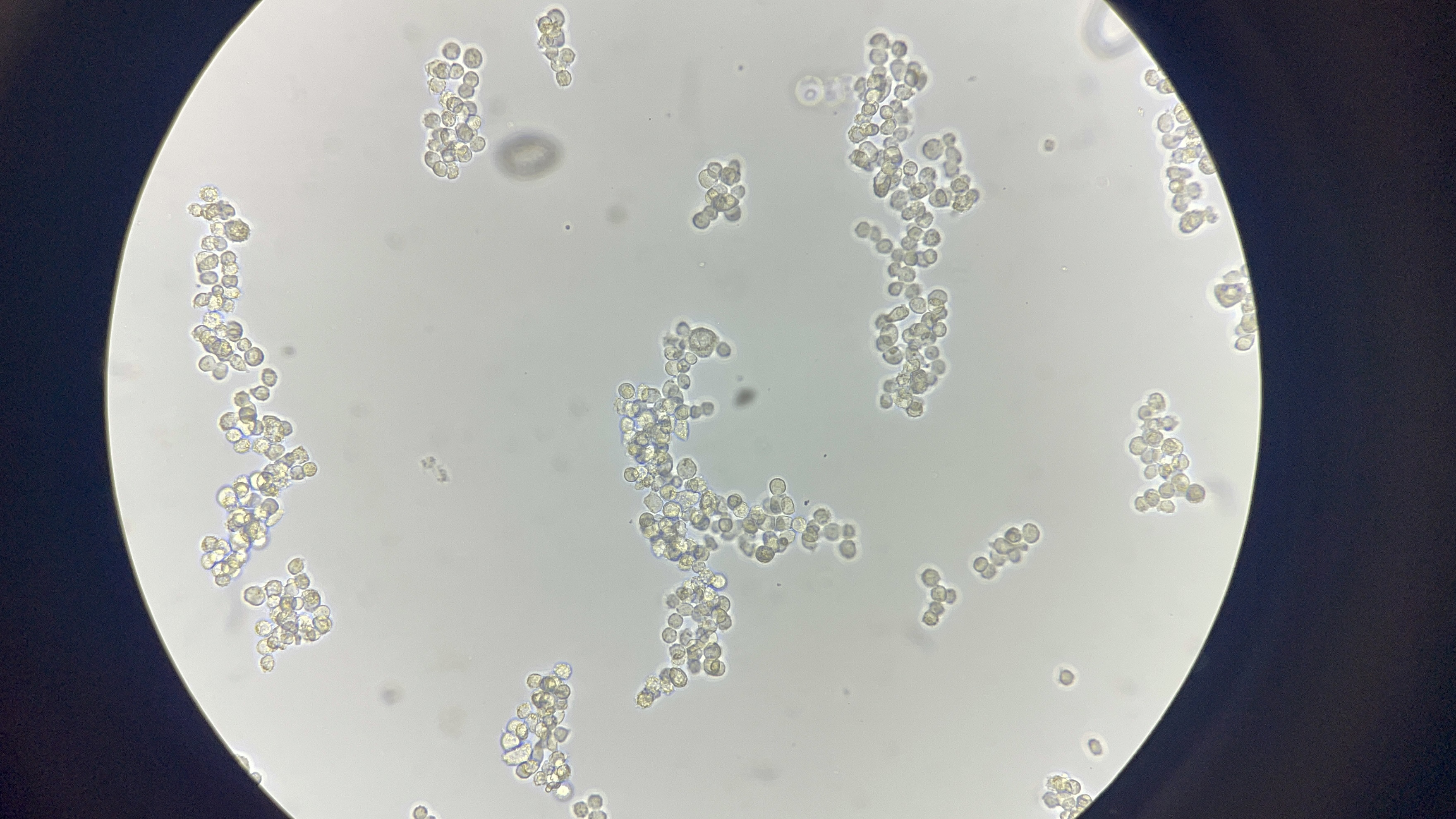 Detached A549 cells before passage 7 (more like in the middle of it)