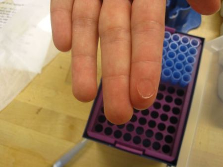 Comparison of 100 microliter aliquot to Sarah's hand